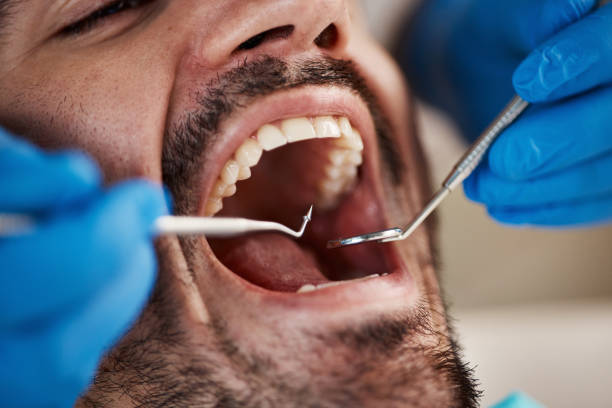 Emergency Dental Services in Purcell, OK